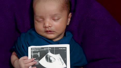 Neugeborenes-Baby,-Das-Eine-Ultraschallkopie-In-Der-Hand-Hält-Und-In-Der-Mutterpalme-In-Der-Babyhülle-Schläft