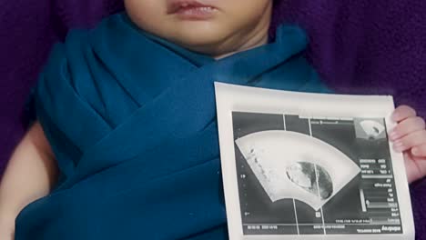 Neugeborenes-Baby,-Das-Eine-Ultraschallkopie-In-Der-Hand-Hält-Und-In-Der-Mutterpalme-In-Der-Babyhülle-Schläft