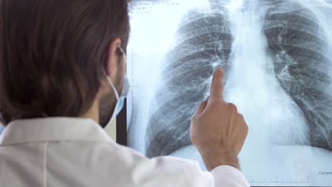 Heart-Condition-Concept---Healthcare-Doctor-Professional-Examining-X-ray