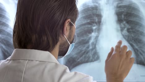 Radiologist-checking-chest-X-ray-scan-of-respiratory-disease