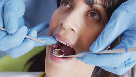 Hände-Eines-Männlichen-Zahnarztes-Untersuchen-Die-Zähne-Einer-Patientin-In-Einer-Modernen-Zahnklinik