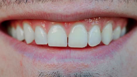 Eine-Nahaufnahme-Eines-Lächelnden-Mannes-Mit-Einer-Kleinen-Lücke-Zwischen-Den-Zähnen