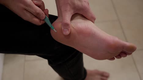 Man-use-scalpel-to-remove-foot-wart-from-his-heel,-close-up