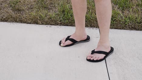 Feet-with-mallet-toe,-toes-crossing-over-each-other,-wearing-sandals