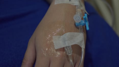 Closed-up-of-hand-infused-with-intravenous-line-IV-for-receiving-fluids,medicine