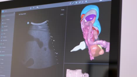 3D-Ultraschall-Menschlicher-Organe