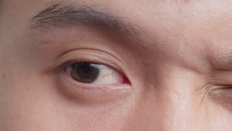 Adult-rubbing-eyelid-providing-momentary-relief-from-fatigue-and-irritation