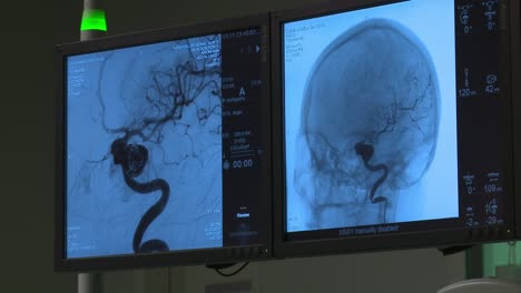 Results-of-patient-medical-scan-displayed-on-hospital-monitor-screen