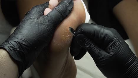 Close-up-hand-chiropodist-peeling-off-skin-with-sharp-scalpel-wearing-black-gloves.