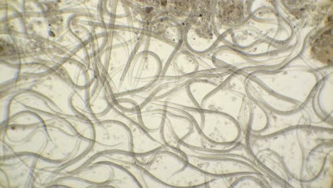 A-microscopic-view-of-roundworms-nematodes,-Steinernema,-at-100-times-magnification