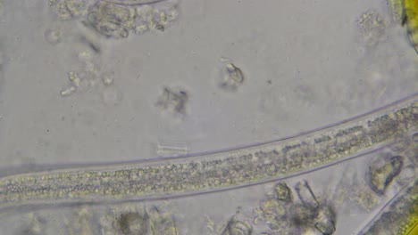 Nemátodos-Nematodos,-Steinernema,-Bajo-El-Microscopio-Con-Un-Aumento-De-600-Veces-Con-Vista-Al-Tracto-Digestivo