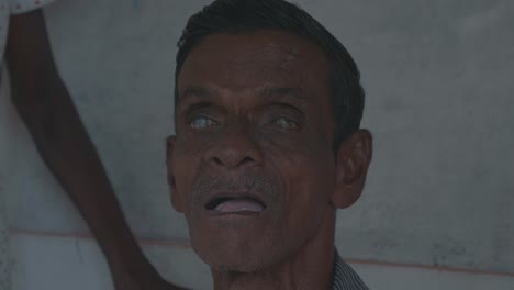 Un-Anciano-Ciego-Y-Discapacitado-Mirando-Directamente-A-La-Cámara-En-Sri-Lanka,-Simbolizando-La-Mala-Situación-Del-Suministro-Médico-En-Los-Países-En-Desarrollo.