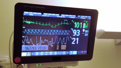 El-Monitor-De-Cardiograma-De-Primer-Plano-En-La-Habitación-Del-Hospital-Muestra-La-Frecuencia-Cardíaca-Y-El-Estado-Del-Paciente