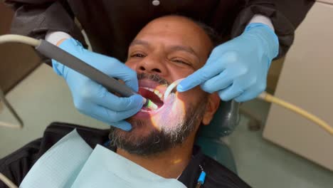 A-close-up-view-of-a-middle-aged-man-of-mixed-races-with-a-beard-at-the-dentist,-getting-his-teeth-cleaned-by-a-dental-hygienist