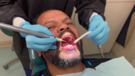 A-close-up-view-of-a-middle-aged-man-with-a-beard-at-the-dentist