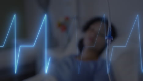 Animation-Eines-Herzfrequenzmessers-über-Einer-Afroamerikanischen-Patientin,-Die-Auf-Dem-Krankenhausbett-Liegt