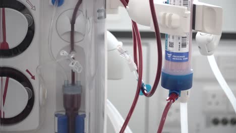 Close-up-of-filtered-blood-going-through-a-dialyzer,-dialysis-machine-in-hospital