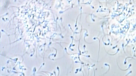 Bewegliches-Sperma-Unter-Dem-Mikroskop