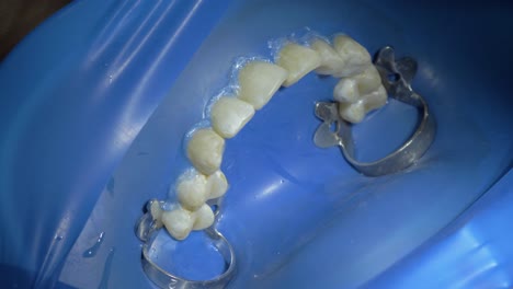 Der-Transformative-Prozess-Der-Zahnreinigung-Und-Zahnaufhellung,-Wie-Er-In-Diesem-Trendigen-Klinik-Filmmaterial-Dargestellt-Wird