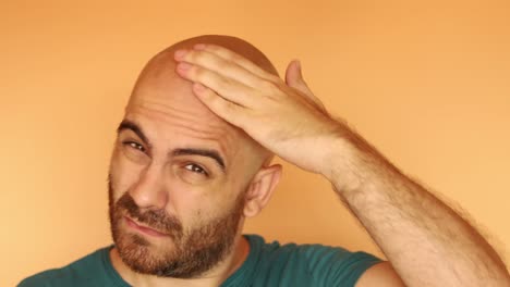 Bearded-bald-sunburned-man,-rubbing-his-head-where-the-skin-is-peeling-off