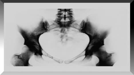 Medizinische-Röntgenaufnahmen