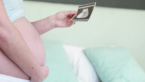 Schwangere-Frau-Schaut-Sich-Ultraschall-An
