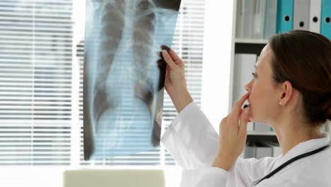 Médico-Examinando-La-Radiografía-De-Tórax