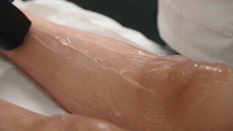 Close-up-of-laser-hair-removal-on-a-woman's-calf,-with-gel-applied-by-a-gloved-technician