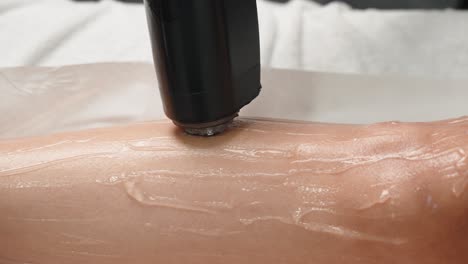 Close-up-of-laser-hair-removal-device-on-a-woman's-leg-covered-with-gel-during-the-procedure