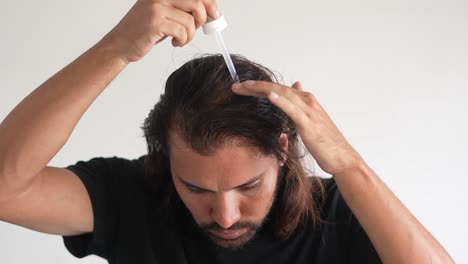 man-applying-minoxidil-to-hair-with-dropper,-baldness,-Balding