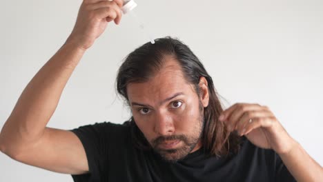 man-applying-minoxidil-to-hair-with-dropper,-baldness,-Hair-growth-serum