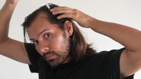 man-applying-minoxidil-to-hair-with-dropper,-baldness,-Hair-density