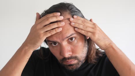 latino-man-checking-his-hair-with-receding-hairline-and-baldness,-Hair-density