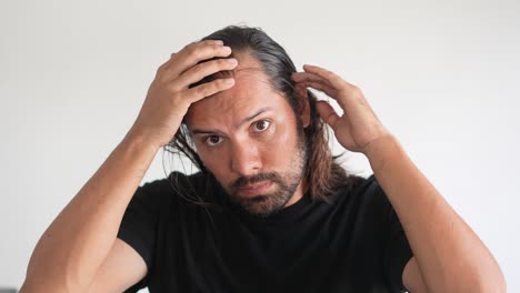 latino-man-checking-his-hair-with-receding-hairline-and-baldness,-scalp